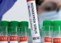 India develops indigenous RT-PCR testing kit for Monkeypox detection